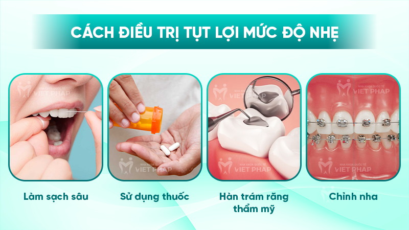 tut loi 5.1 Cách điều trị tụt lợi mức độ nhẹ