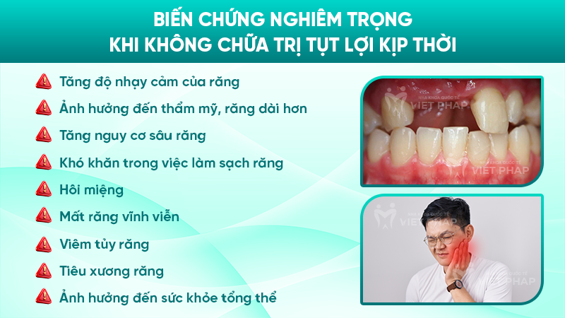 tut loi 6 Biến chứng nghiêm trọng khi không chữa trị tụt lợi kịp thời