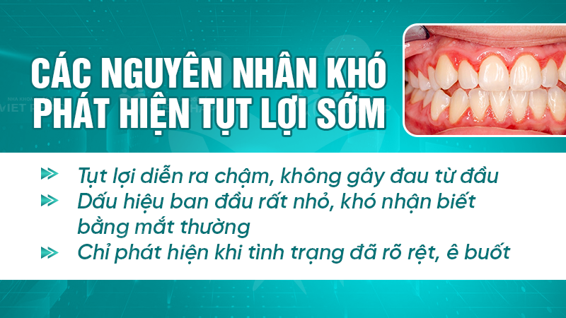 tut loi co the tu khoi khong nha khoa quoc te viet phap 3 Nguyên nhân khó phát hiện tụt lợi sớm khiến nhiều người chủ quan