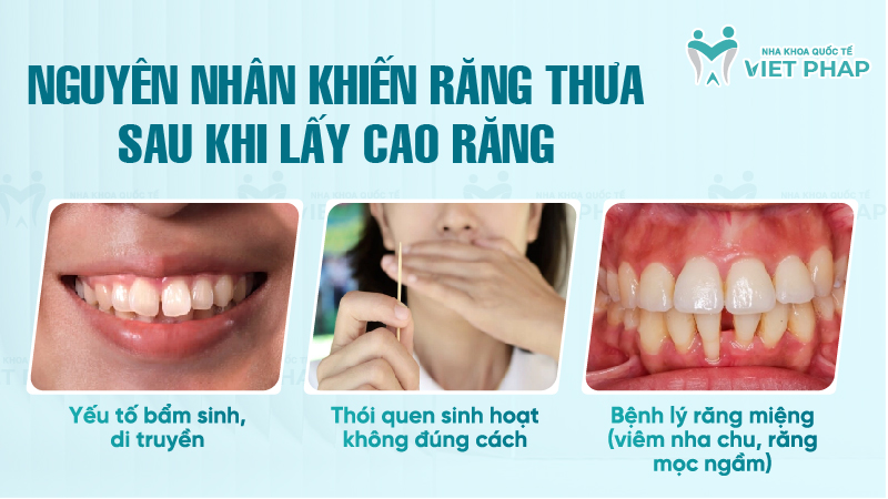 Nguyên nhân khiến răng thưa sau khi lấy cao răng