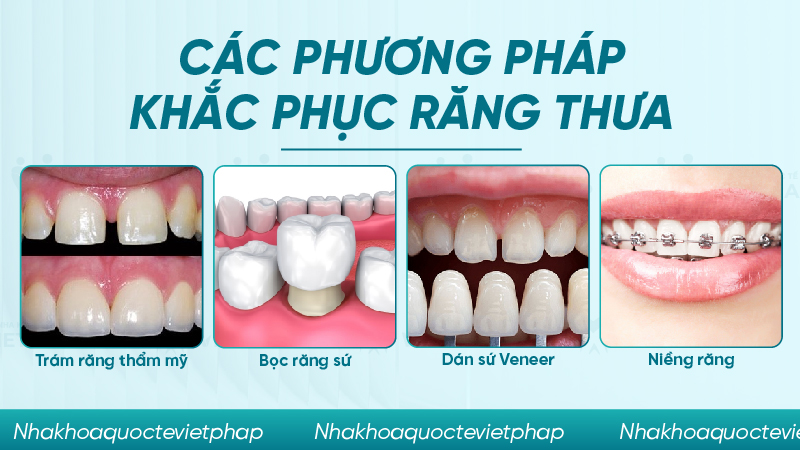 Các phương pháp khắc phục răng thưa