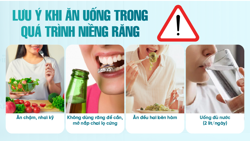 Lưu ý khi ăn uống trong quá trình niềng răng