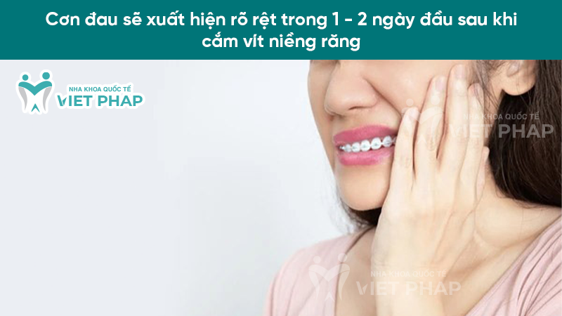 Cơn đau sẽ xuất hiện rõ rệt trong 1 - 2 ngày đầu sau khi cắm vít niềng răng