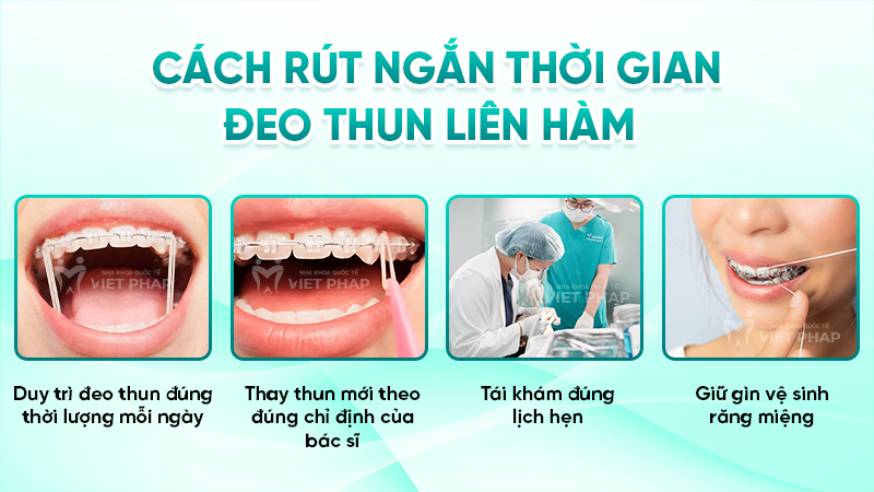 deo thun lien ham may thang 4 Cách rút ngắn thời gian đeo thun liên hàm