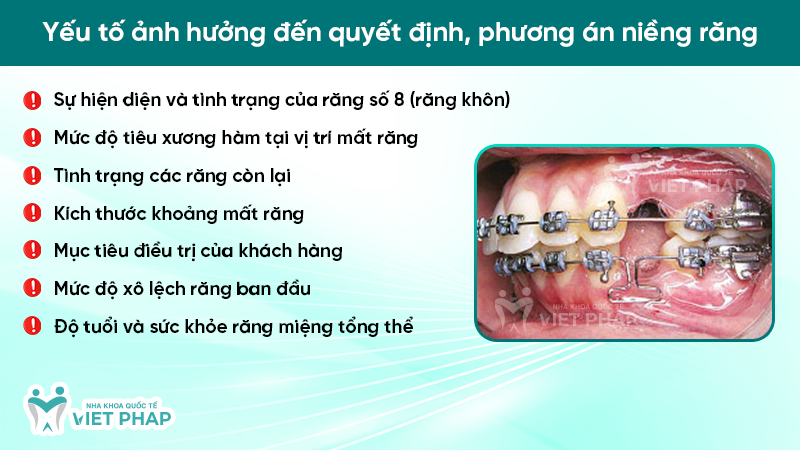 mat rang so 6 va 7 co nieng duoc khong 2.7 Yếu tố ảnh hưởng đến quyết định, phương án niềng răng