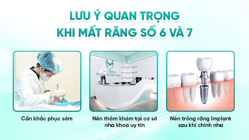 mat rang so 6 va 7 co nieng duoc khong 4 Lưu ý quan trọng khi mất răng số 6 và 7