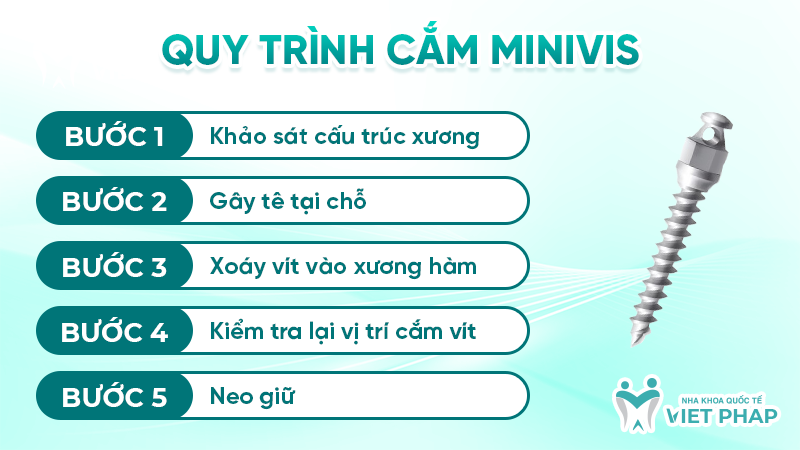Quy trình cắm Minivis