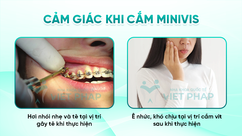Cảm giác khi cắm minivis