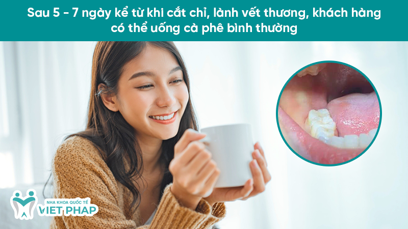 Sau 5 - 7 ngày kể từ khi cắt chỉ, lành vết thương, khách hàng có thể uống cà phê bình thường
