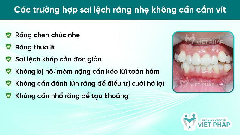 Các trường hợp sai lệch răng nhẹ không cần cắm vít