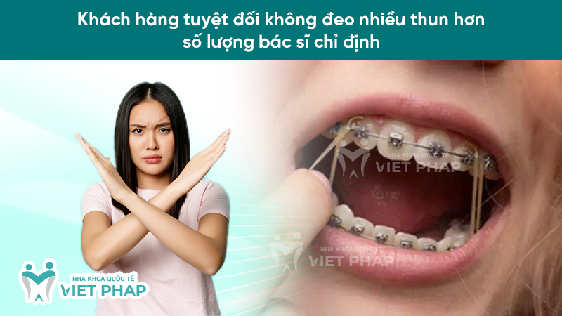 thun lien ham 11 Khách hàng tuyệt đối không đeo nhiều thun hơn số lượng bác sĩ chỉ định