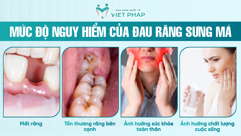 Mức độ nguy hiểm của đau răng sưng má