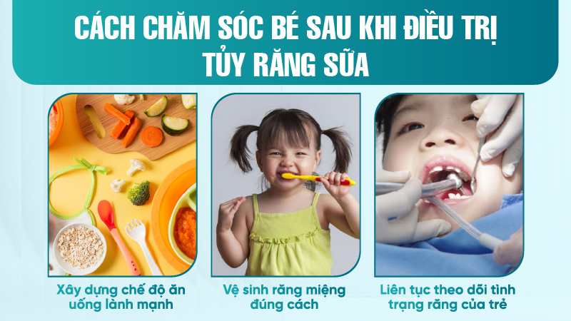Dieu tri tuy rang sua 5 Cách chăm sóc bé sau khi điều trị tủy răng sữa
