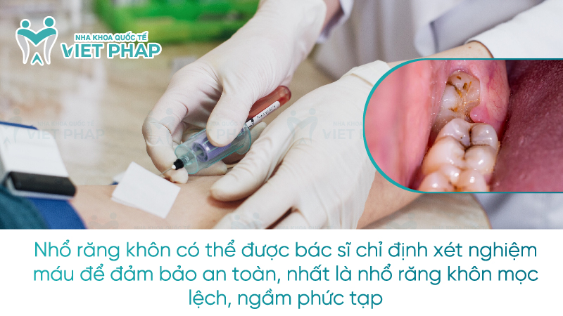 Nhổ răng khôn có thể được bác sĩ chỉ định xét nghiệm máu để đảm bảo an toàn, nhất là nhổ răng khôn mọc lệch, ngầm phức tạp