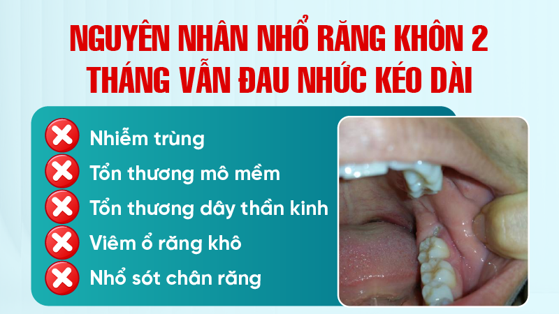 Nguyên nhân nhổ răng khôn 2 tháng vẫn đau nhức kéo dài