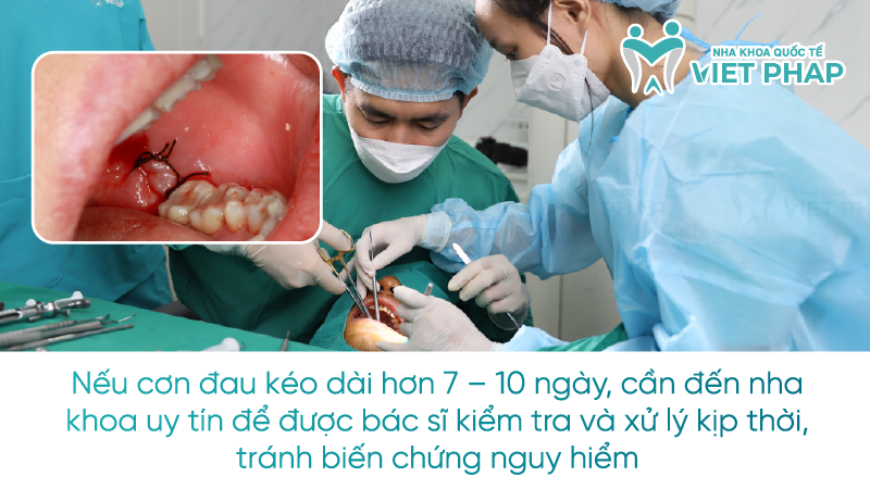 Nếu cơn đau kéo dài hơn 7 – 10 ngày, cần đến nha khoa uy tín để được bác sĩ kiểm tra và xử lý kịp thời, tránh biến chứng nguy hiểm