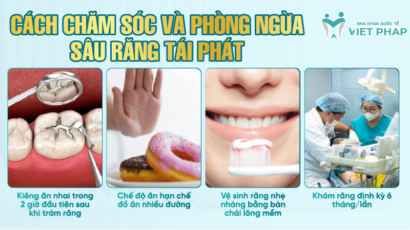Rang sau do 2 la nhu the nao 6 Cách chăm sóc và phòng ngừa sâu răng tái phát