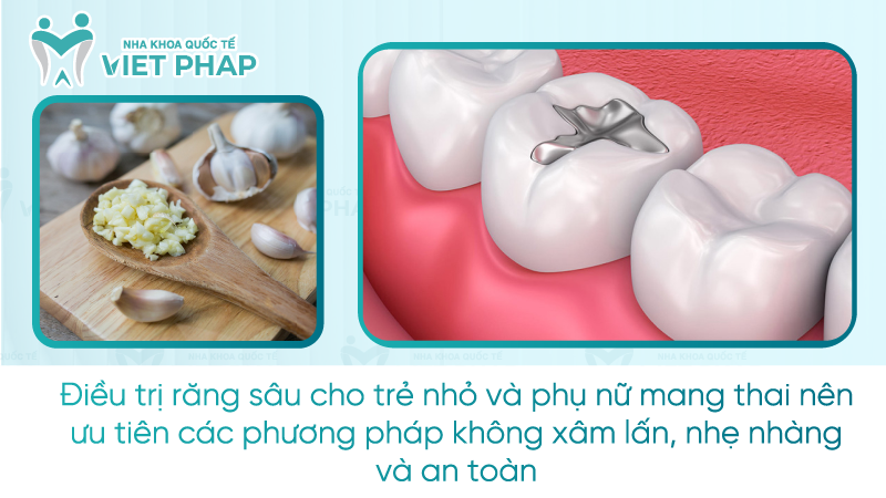 Rang sau do 2 la nhu the nao 8 Điều trị răng sâu cho trẻ nhỏ và phụ nữ mang thai nên ưu tiên các phương pháp không xâm lấn, nhẹ nhàng và an toàn