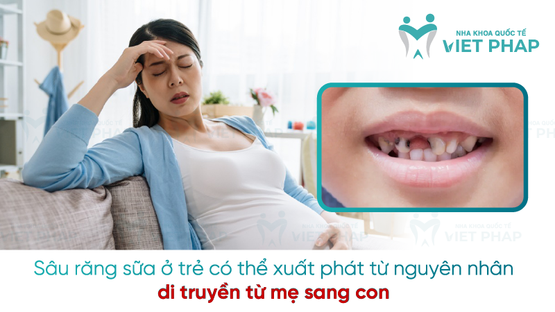 Sau rang sua 6 Sâu răng sữa ở trẻ có thể xuất phát từ nguyên nhân di truyền từ mẹ sang con