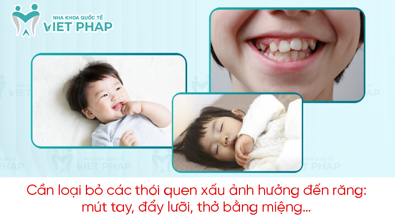 Tai sao rang sua chua rung da moc rang moi 8 Cần loại bỏ các thói quen xấu ảnh hưởng đến răng: mút tay, đẩy lưỡi, thở bằng miệng…