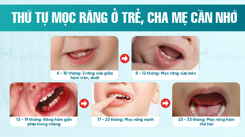 Tre em may thang moc rang 3 Thứ tự mọc răng ở trẻ, cha mẹ cần nhớ