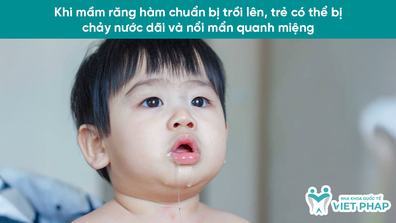 hinh anh tre sap moc rang ham 2.1 Khi mầm răng hàm chuẩn bị trồi lên, trẻ có thể bị chảy nước dãi và nổi mẩn quanh miệng