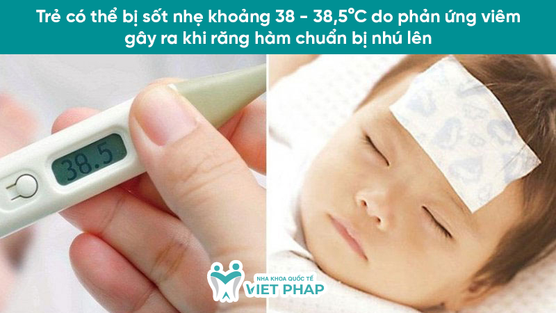 hinh anh tre sap moc rang ham 2.5 Trẻ có thể bị sốt nhẹ khoảng 38 - 38,5°C do phản ứng viêm gây ra khi răng hàm chuẩn bị nhú lên