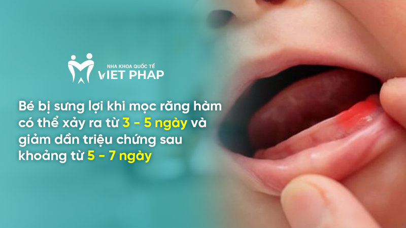 hinh anh tre sap moc rang ham 3 Bé bị sưng lợi khi mọc răng hàm có thể xảy ra từ 3 - 5 ngày và giảm dần triệu chứng sau khoảng từ 5 - 7 ngày