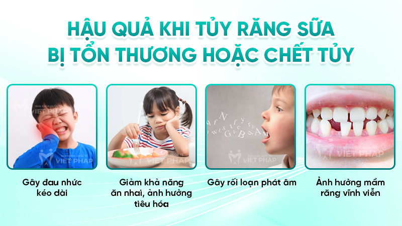 rang sua co tuy khong 3 Hậu quả khi tủy răng sữa bị tổn thương hoặc chết tủy
