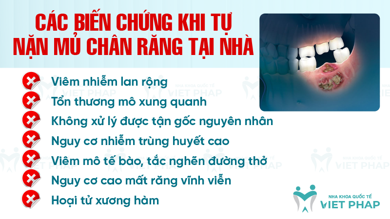 Các biến chứng khi tự nặn mủ chân răng tại nhà