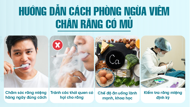 Hướng dẫn cách phòng ngừa viêm chân răng có mủ