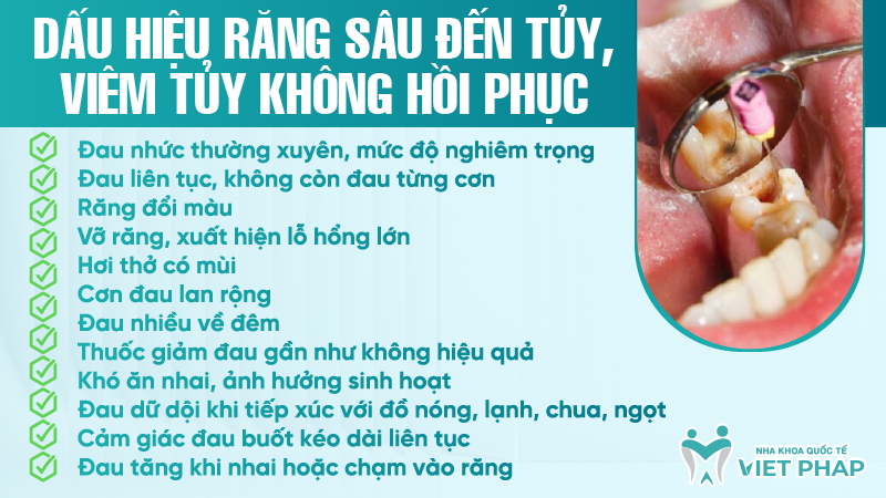 Dấu hiệu răng sâu đến tủy, viêm tủy không hồi phục