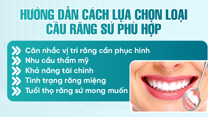 Hướng dẫn cách lựa chọn loại cầu răng sứ phù hợp