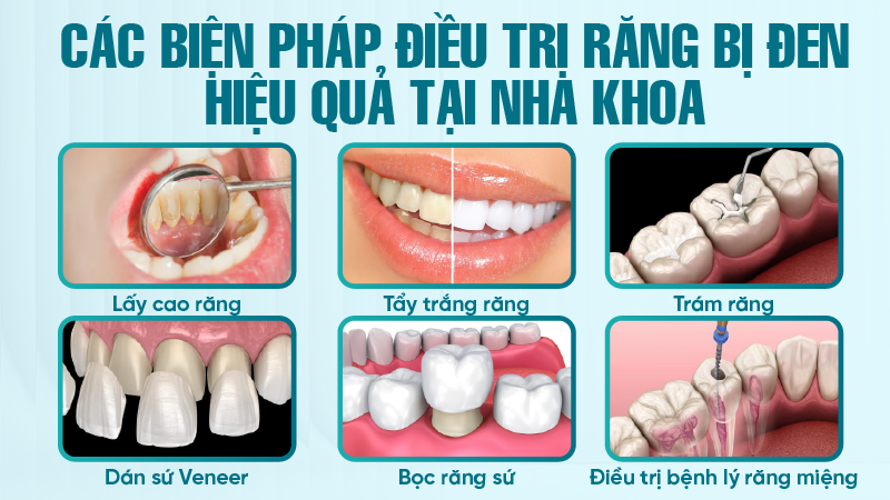 Các biện pháp điều trị răng bị đen hiệu quả tại nha khoa
