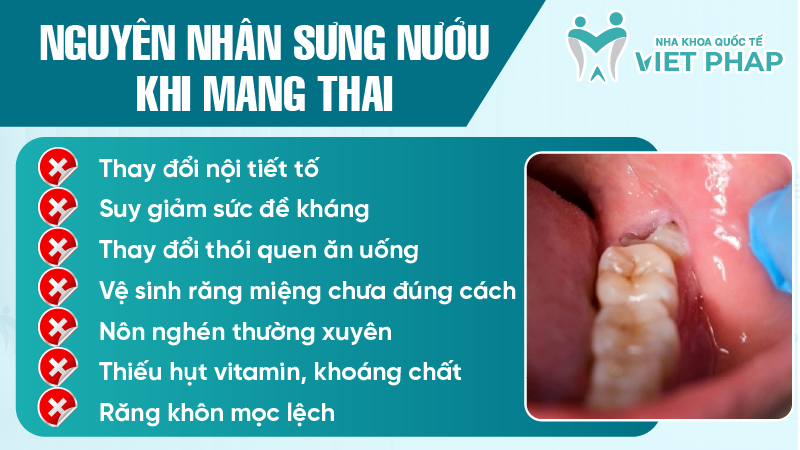 Sung nuou khi mang thai 2 Nguyên nhân sưng nướu khi mang thai