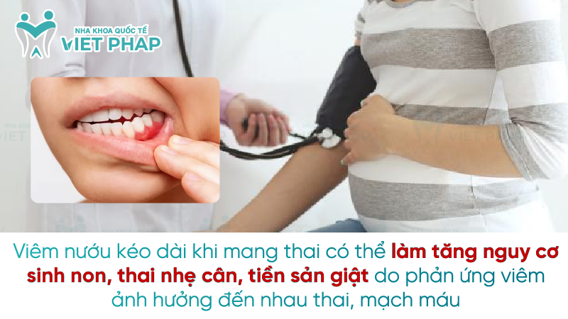 Sung nuou khi mang thai 5 Viêm nướu kéo dài khi mang thai có thể làm tăng nguy cơ sinh non, thai nhẹ cân, tiền sản giật do phản ứng viêm ảnh hưởng đến nhau thai, mạch máu