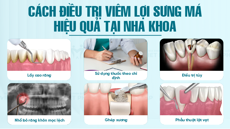 Cách điều trị viêm lợi sưng má hiệu quả tại nha khoa 