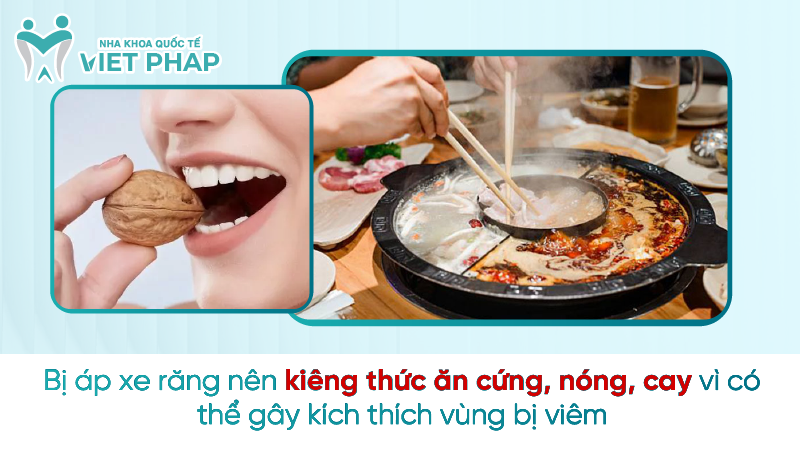 ap xe rang la gi 12 1 Bị áp xe răng nên kiêng thức ăn cứng, nóng, cay vì có thể gây kích thích vùng bị viêm