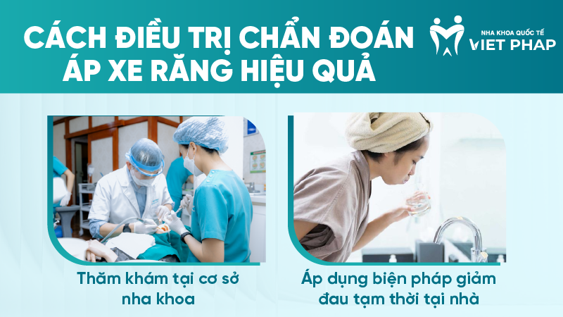 ap xe rang la gi 7 Cách điều trị chẩn đoán áp xe răng hiệu quả