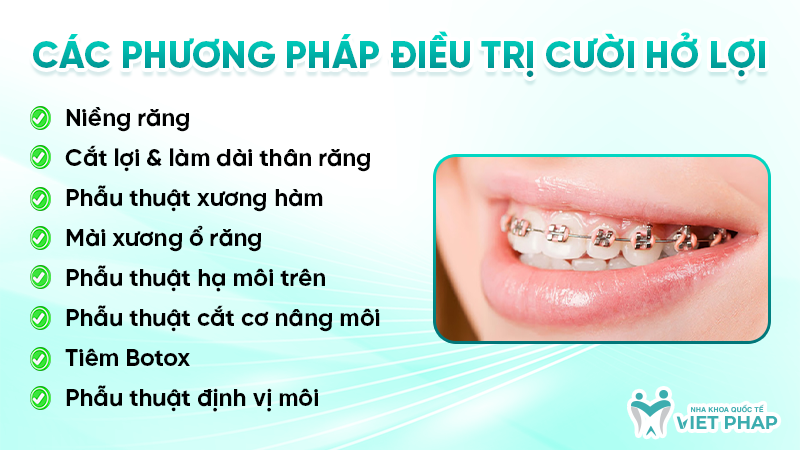 Các phương pháp điều trị cười hở lợi