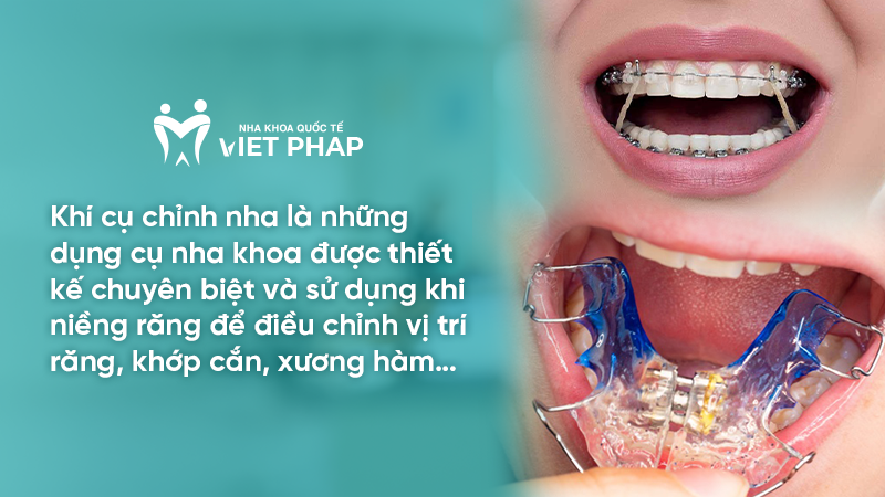 Khí cụ chỉnh nha là những dụng cụ nha khoa được thiết kế chuyên biệt và sử dụng khi niềng răng để điều chỉnh vị trí răng, khớp cắn, xương hàm…