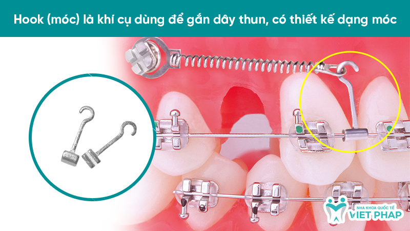 Hook (móc) là khí cụ dùng để gắn dây thun, có thiết kế dạng móc