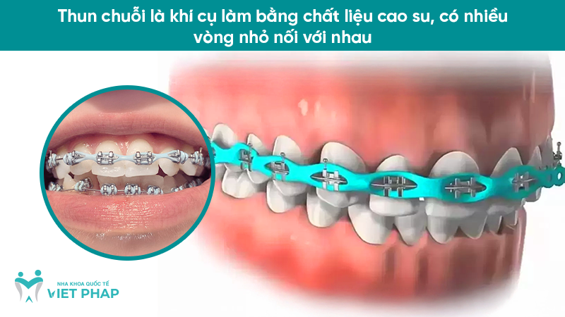 Thun chuỗi là khí cụ làm bằng chất liệu cao su, có nhiều vòng nhỏ nối với nhau