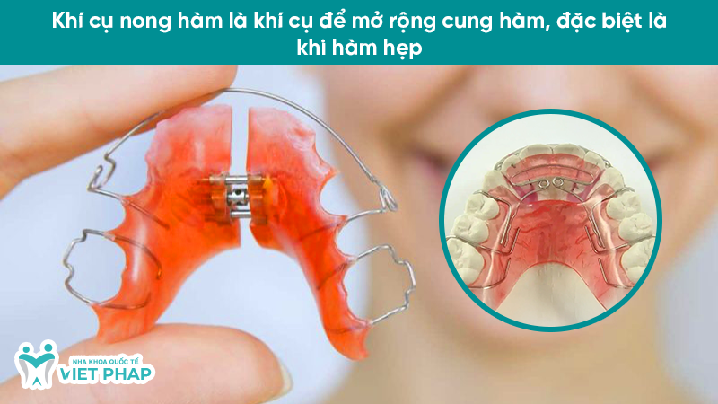 Khí cụ nong hàm là khí cụ để mở rộng cung hàm, đặc biệt là khi hàm hẹp