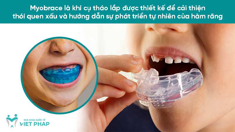 Myobrace là khí cụ tháo lắp được thiết kế để cải thiện thói quen xấu và hướng dẫn sự phát triển tự nhiên của hàm răng