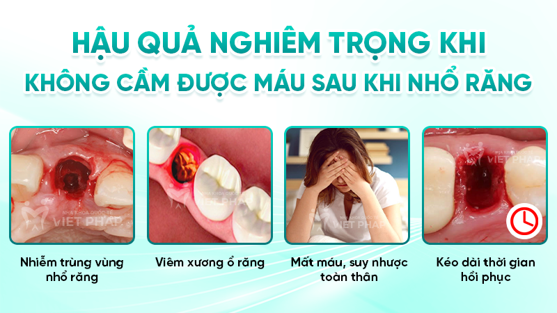 Hậu quả nghiêm trọng khi không cầm được máu sau khi nhổ răng