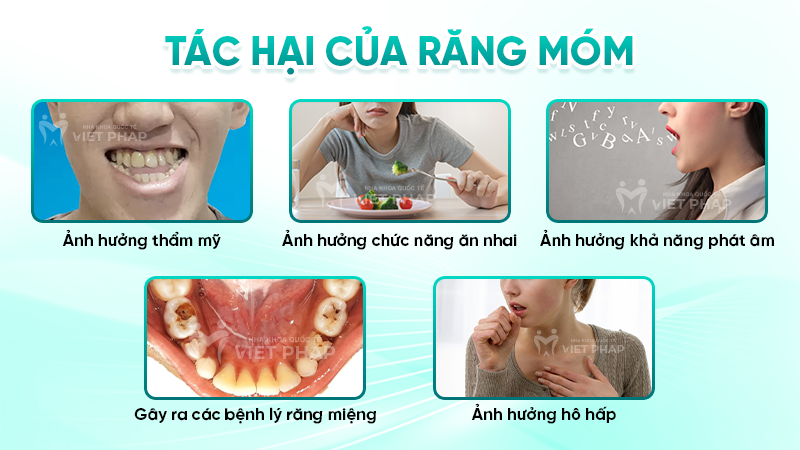 rang mom 5 Tác hại của răng móm