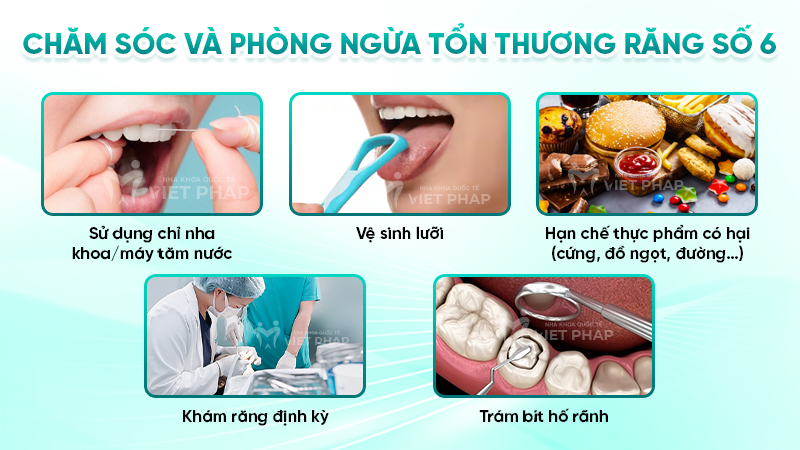 Chăm sóc và phòng ngừa tổn thương răng số 6