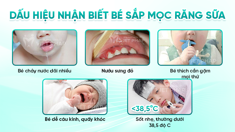 Dấu hiệu nhận biết bé sắp mọc răng sữa