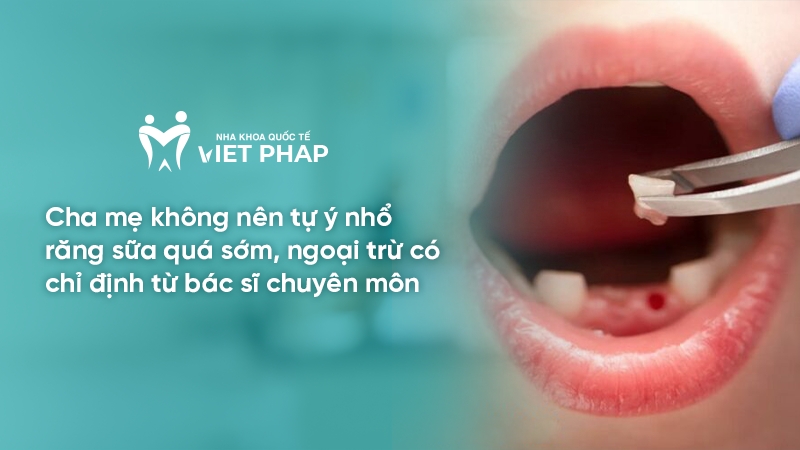 Cha mẹ không nên tự ý nhổ răng sữa quá sớm, ngoại trừ có chỉ định từ bác sĩ chuyên môn